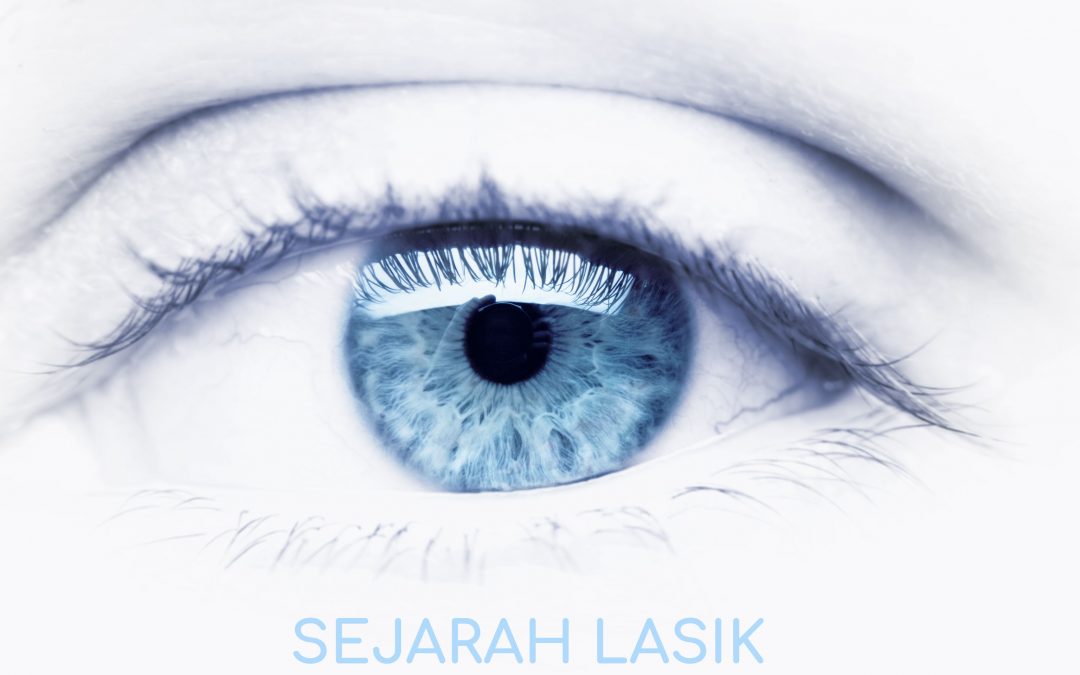 Sejarah LASIK (Laser Assisted In Situ Keratomileusis)