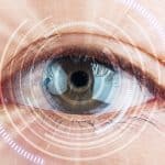 perbandingan metode lasik
