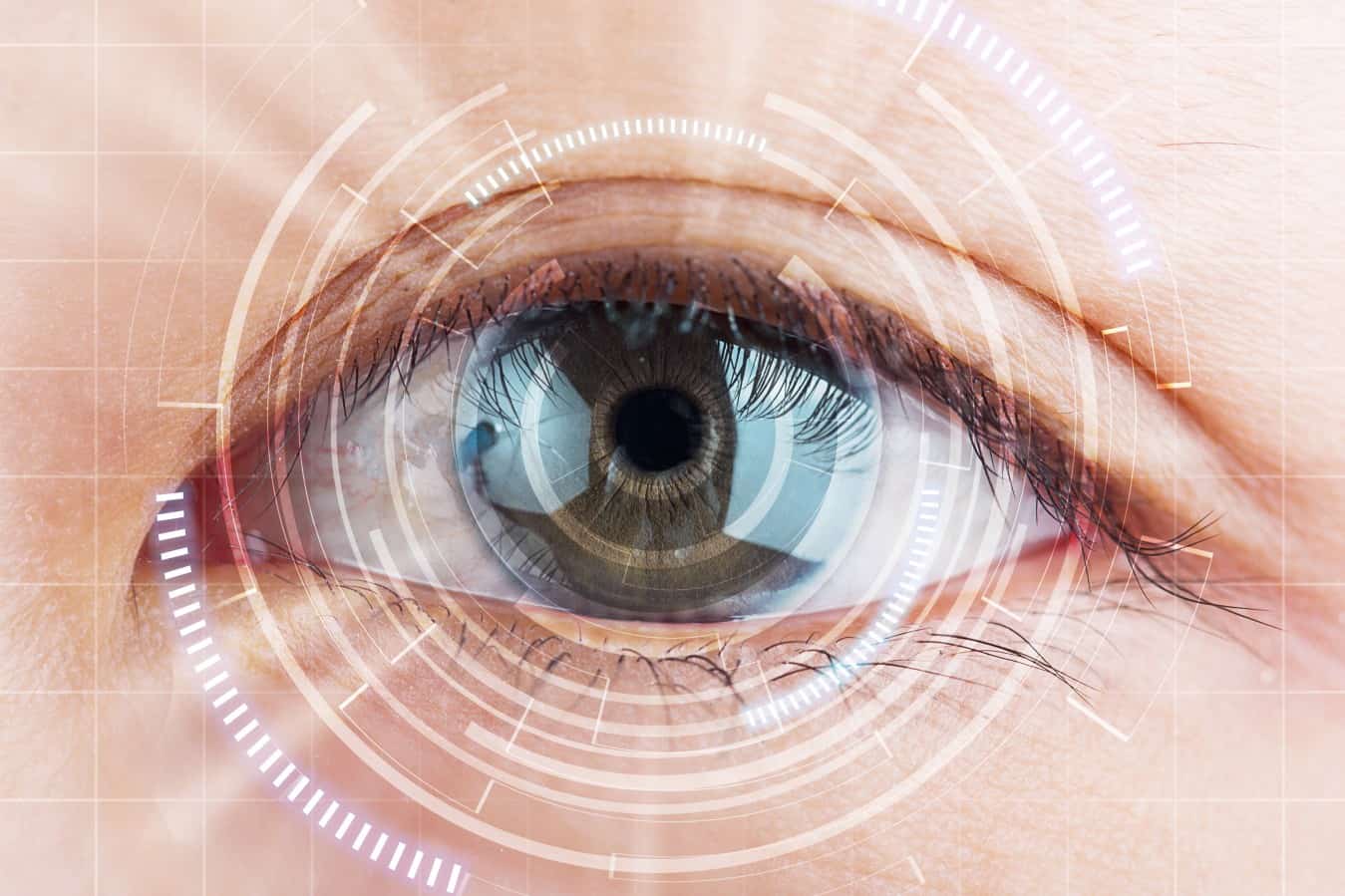 perbandingan metode lasik