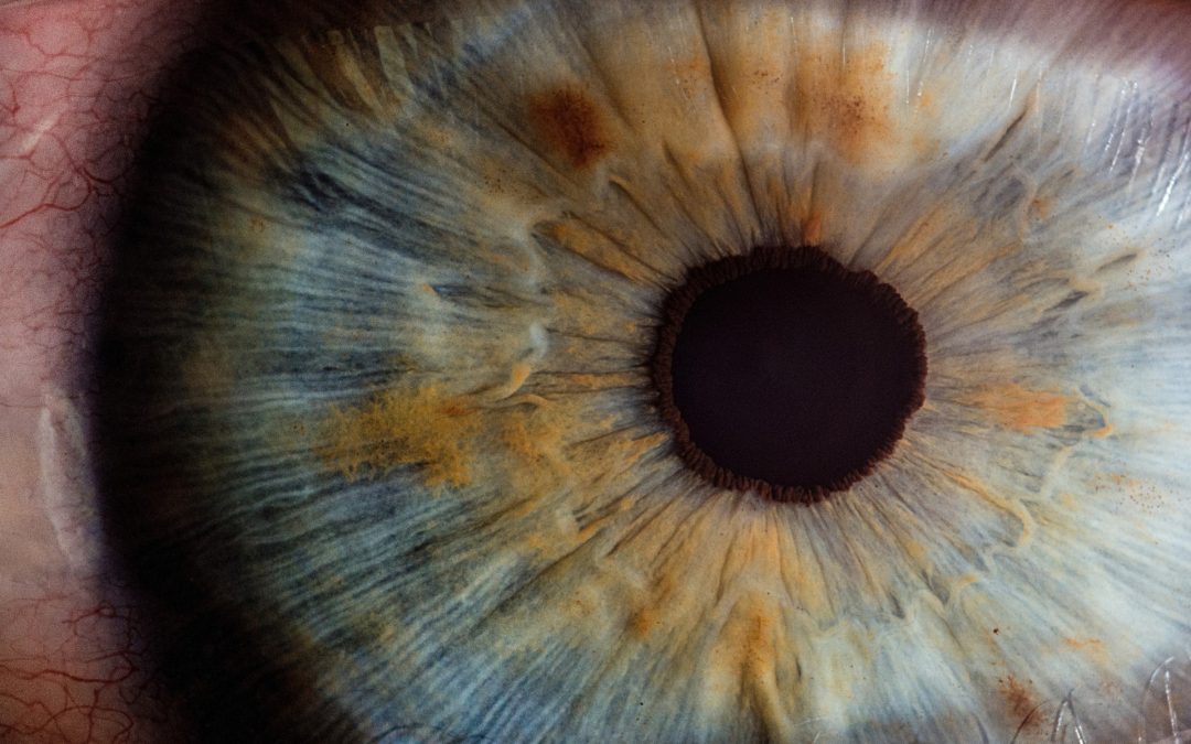 Setelah Operasi Katarak: Ini yang harus Dilakukan