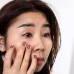 penyebab mata gatal dan merah