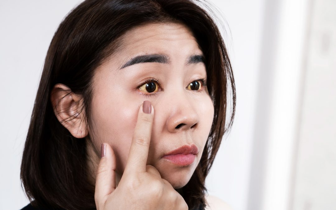 Tanda-Tanda Operasi Katarak Gagal dan Efek Sampingnya